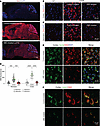 Base-editor treatment reduces brain GM2 ganglioside accumulation in LOTS mi