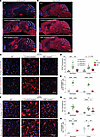 Base-editor treatment reduces glial-cell response in the brain of LOTS mice