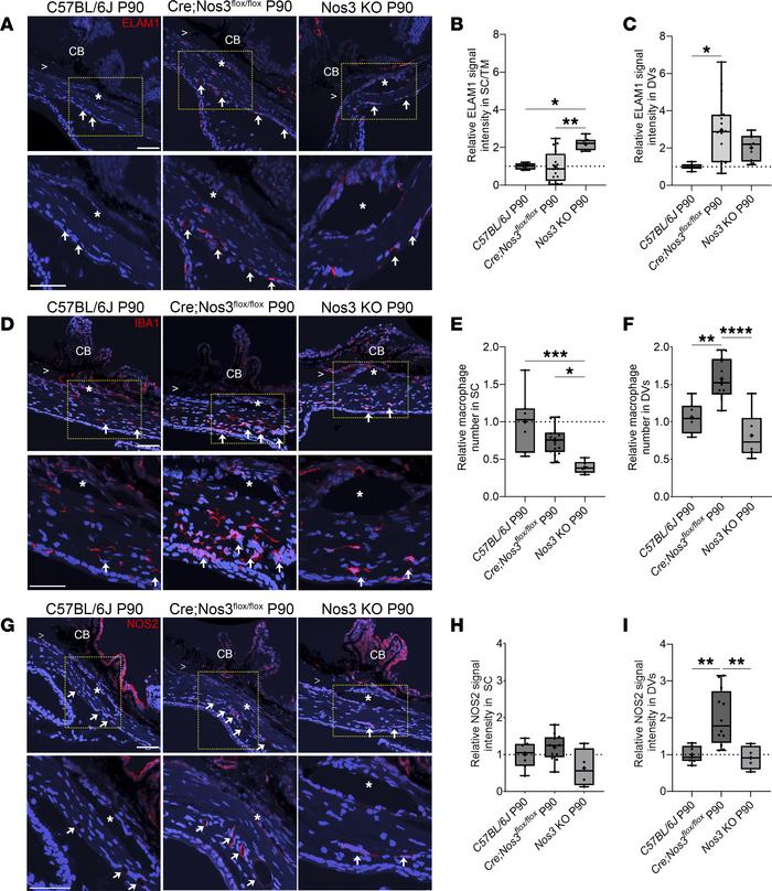 Increased ELAM1 protein expression coincides with recruitment of IBA1+ m...