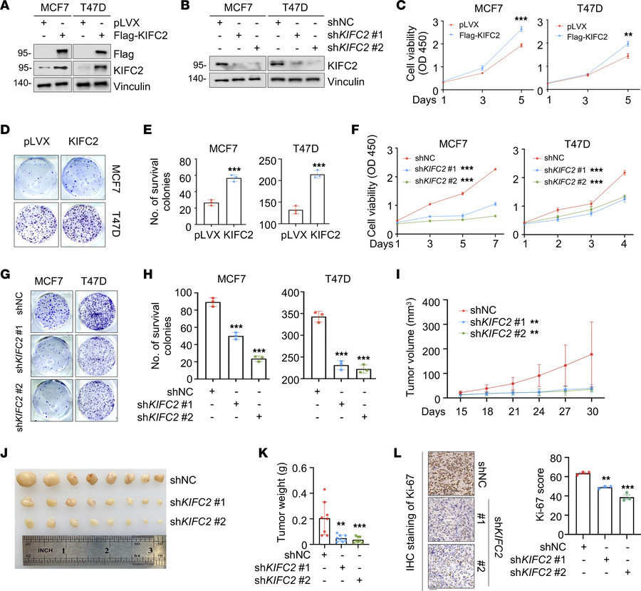 KIFC2 promotes the growth of HR+/HER2– BC cells both in vitro and in mou...
