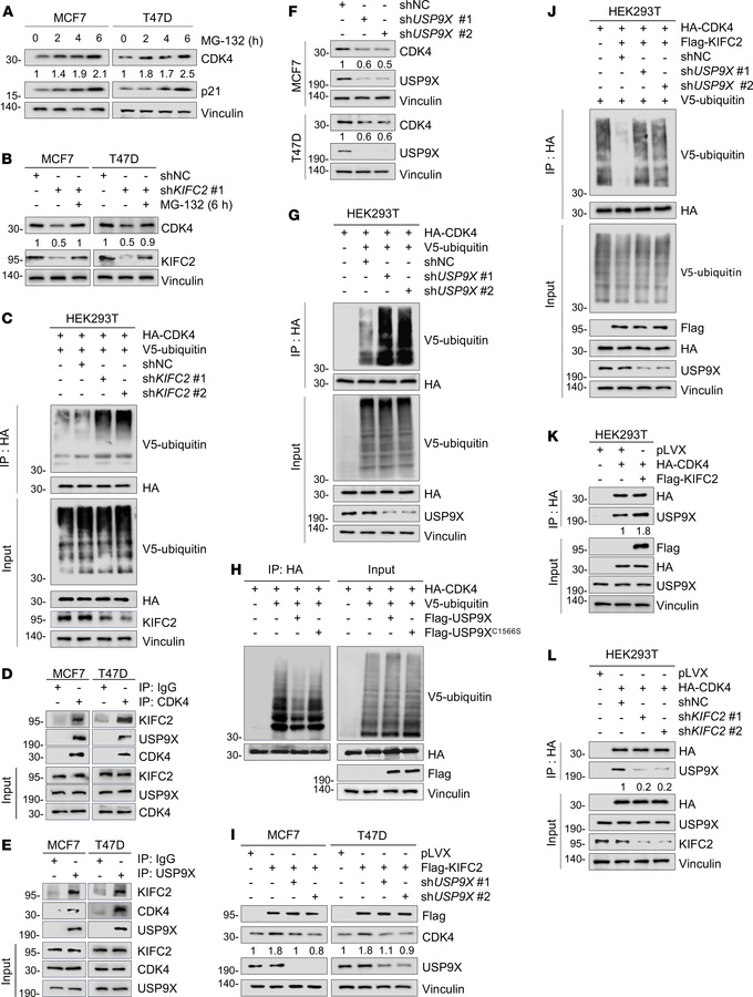 KIFC2 recruits USP9X to stabilize CDK4.
(A) MCF7 and T47D cells were tre...