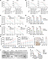 Knockdown of KIFC2 enhances the sensitivity of HR+/HER2– BC cells to the ET