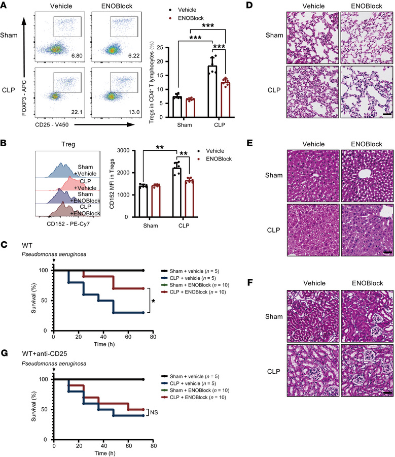Inhibition of ENO1 decreased Treg differentiation and alleviated septic ...