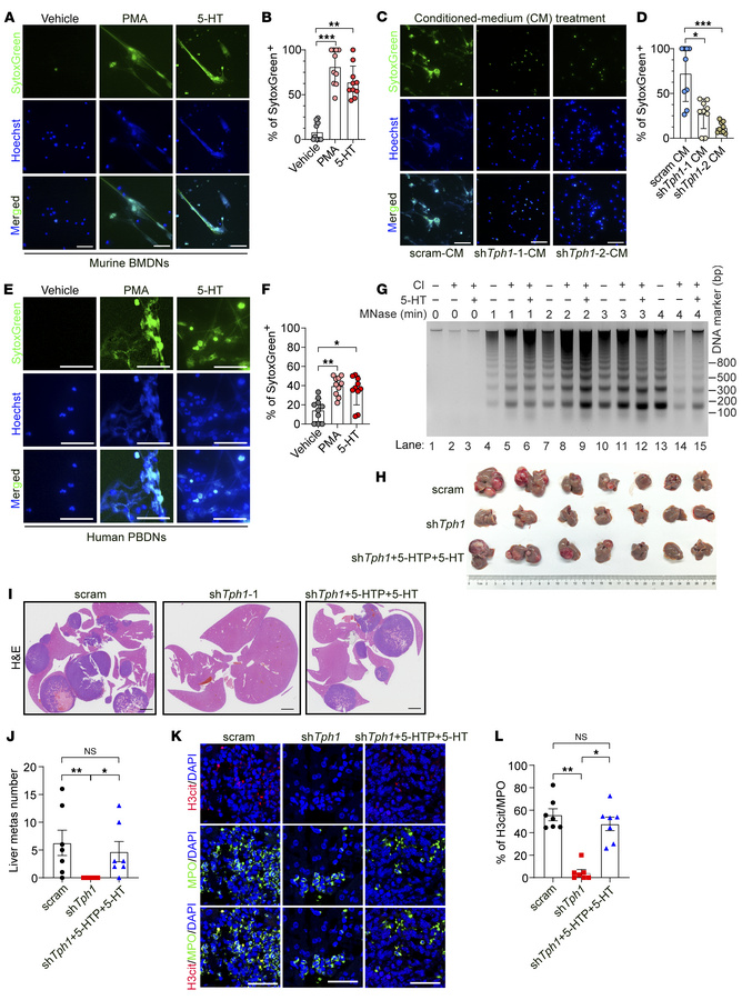 NEPC-derived 5-HT potentiates the formation of NETs and liver metastasis...