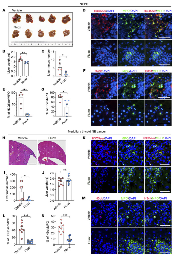 The SERT inhibitor Fluox represses NET formation and liver metastasis in...