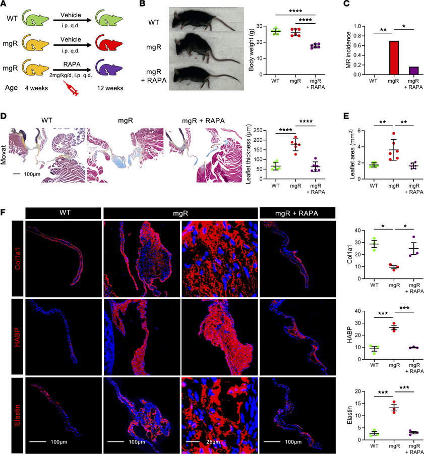 Long-term treatment with rapamycin rescues the mitral valve and skeletal...