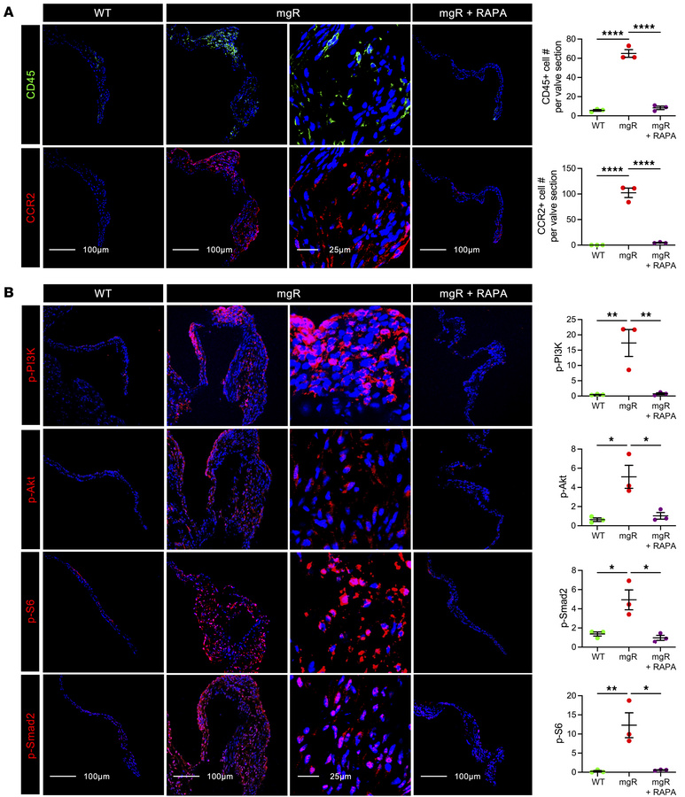Long-term treatment with rapamycin prevents recruitment of macrophages a...