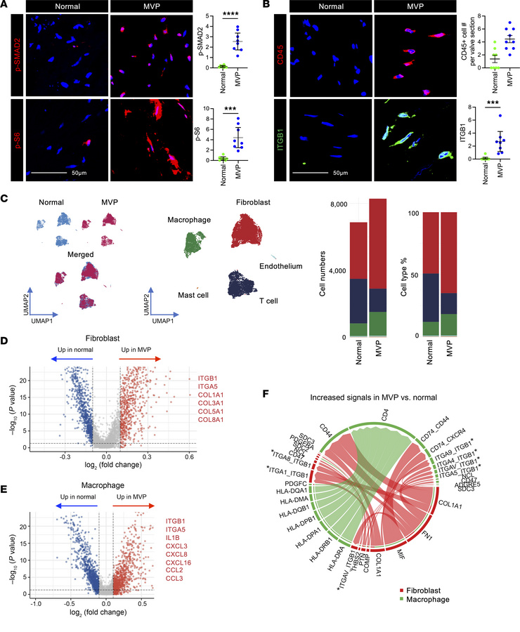 Evidence of TGF-β and mTOR signaling activation and β1 integrin expressi...