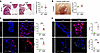 TGF-β and mTOR signaling activation and leukocyte accumulation without mitr