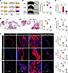 Long-term treatment with rapamycin rescues the mitral valve and skeletal ph