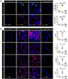 Long-term treatment with rapamycin prevents recruitment of macrophages and