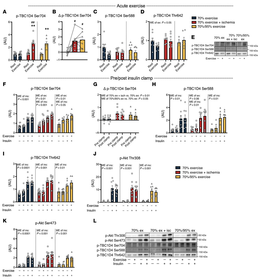 Enhanced phosphorylation of TBC1D4 after exercise and insulin stimulatio...