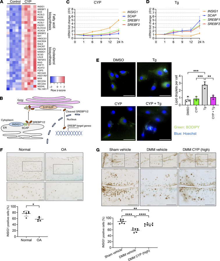 Cyproheptadine regulation of ER stress-induced lipid/cholesterol biosynt...