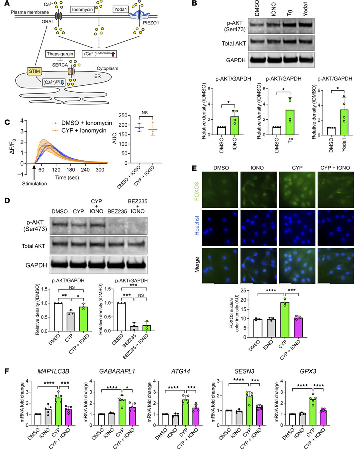 Mechanisms of cyproheptadine effects on the FOXO/autophagy axis via calc...