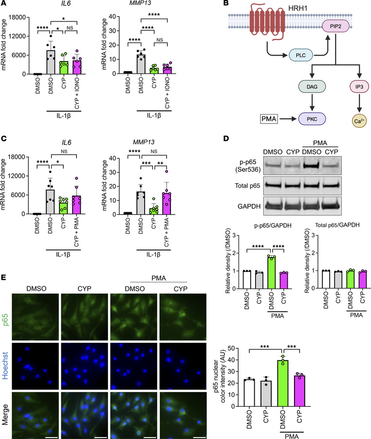 Mechanisms of cyproheptadine antiinflammatory effects via protein kinase...