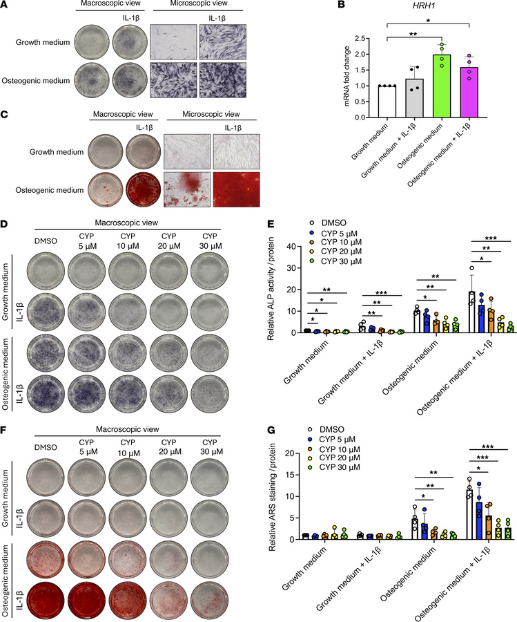 Effects of cyproheptadine on osteogenesis.
(A) Alkaline phosphatase (ALP...