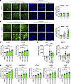 Effects of cyproheptadine in human chondrocytes.