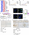 Cyproheptadine regulation of ER stress-induced lipid/cholesterol biosynthes