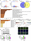 Antiinflammatory effects of cyproheptadine via NF-κB pathway.