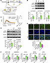 Mechanisms of cyproheptadine effects on the FOXO/autophagy axis via calcium