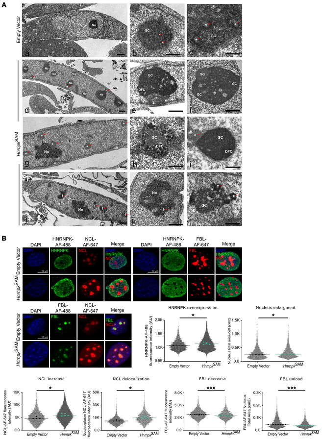 HNRNPK overexpression promotes nucleolar fragmentation and dysregulates ...