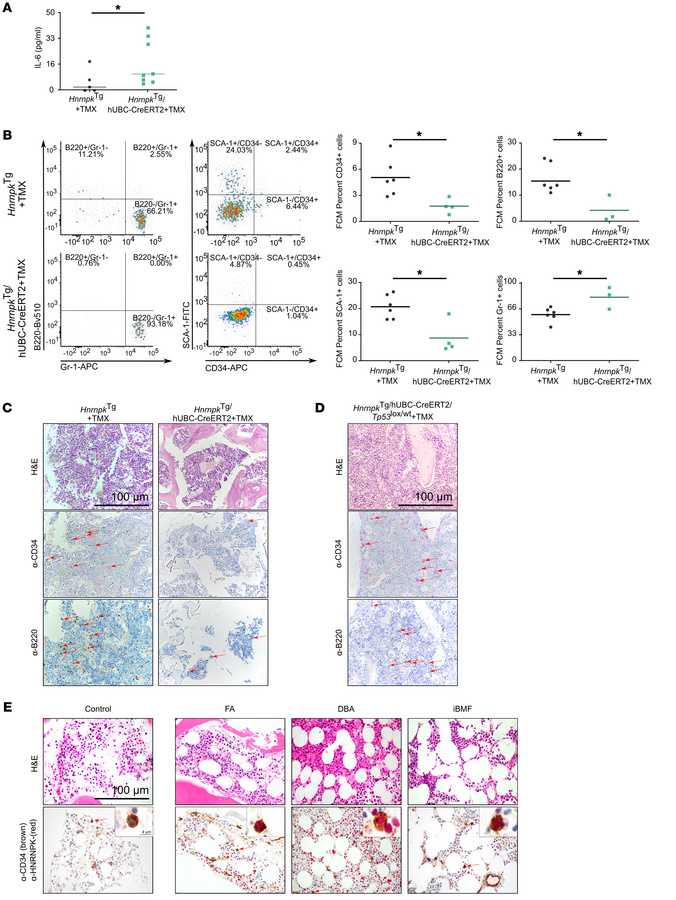 hnRNP K overexpression drives bone marrow failure in vivo.
(A) In vivo s...