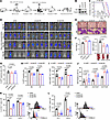 Jab1 facilitates immune evasion and sustains leukemia progression in MLL-AF