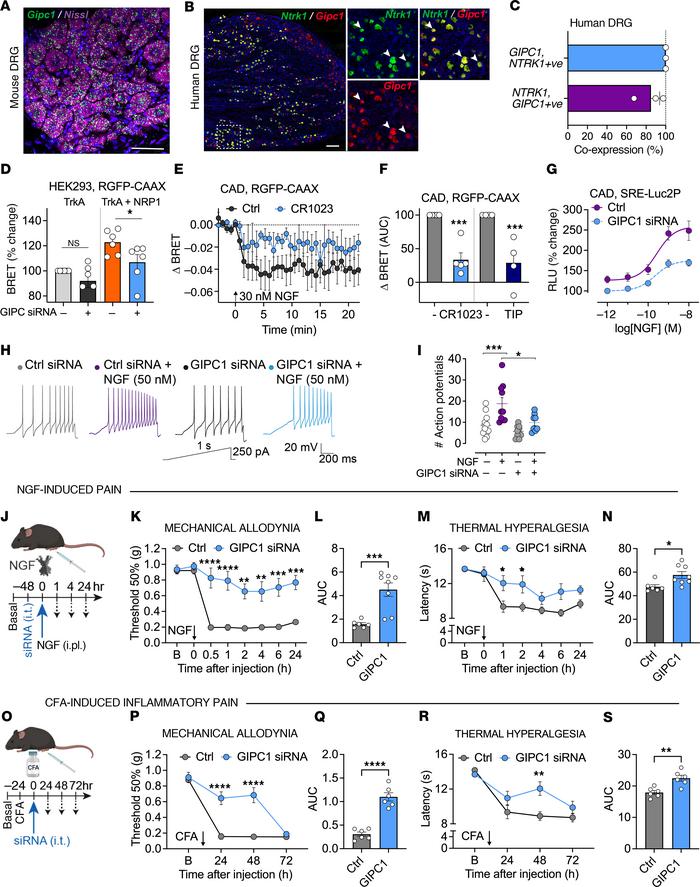 GIPC1 modulates TrkA trafficking, signaling, and NGF-induced nociception...