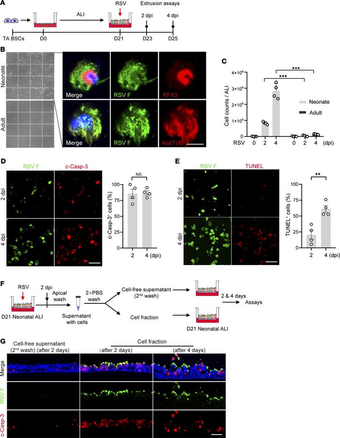 Apoptotic cell extrusion in neonatal epithelium model following RSV infe...