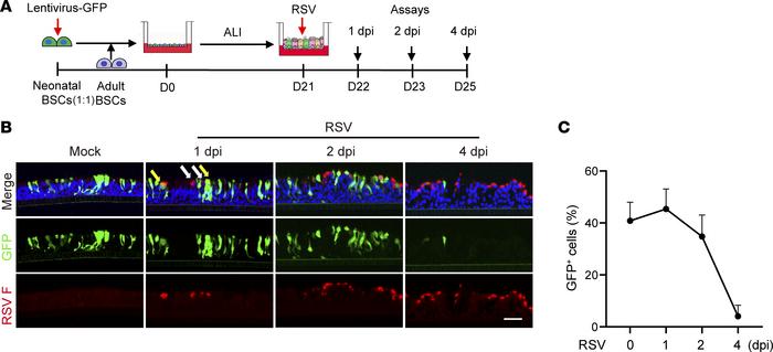 Age regulates bronchial epithelial cell survival following RSV infection...