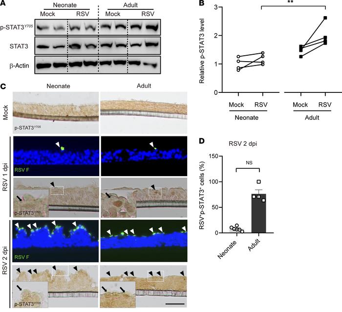 Age regulates STAT3 activation following RSV infection in ciliated cells...