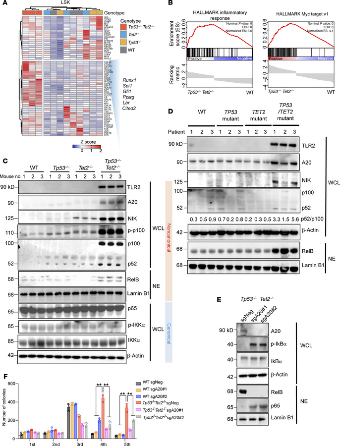 Myeloid predisposition and enhanced innate immune signaling in Tp53–/–Te...