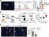 CXCR3 chemokine receptor drives NK cell infiltration in liver metastasis.
