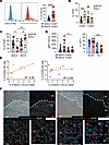 F4/80hi MAMs from MC38 but not SL4-induced metastasis include subsets expre