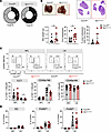 Deletion of Cxcr3 in Ncr1+ ILCs impairs CD49a+ NK generation and accelerate