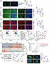 LAIR1 inhibition reduces tumor collagen IV by lowering FXIII-A in M2-like T