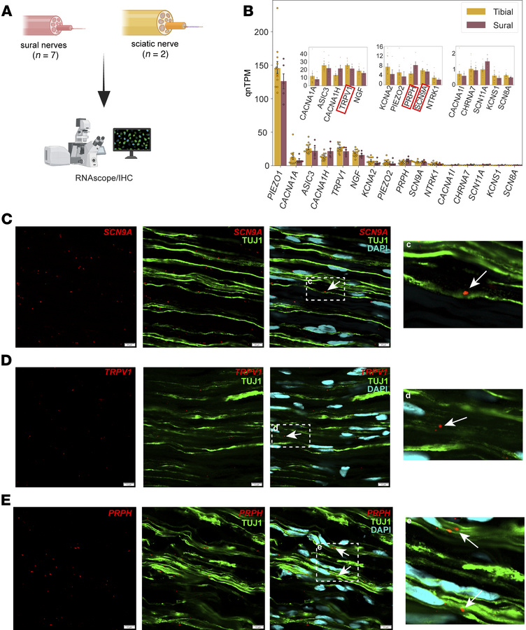 Gene expression in human peripheral nerves.
(A) Overview of samples used...