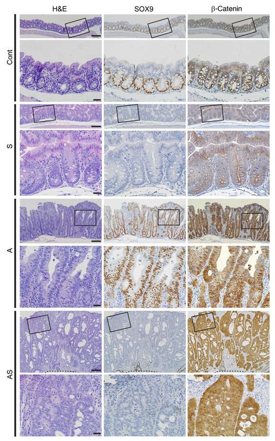 Morphological changes in colon epithelium in mice with inactivation of S...