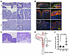 Mouse colon lesions with combined Apc and Sox9 inactivation had enhanced dy