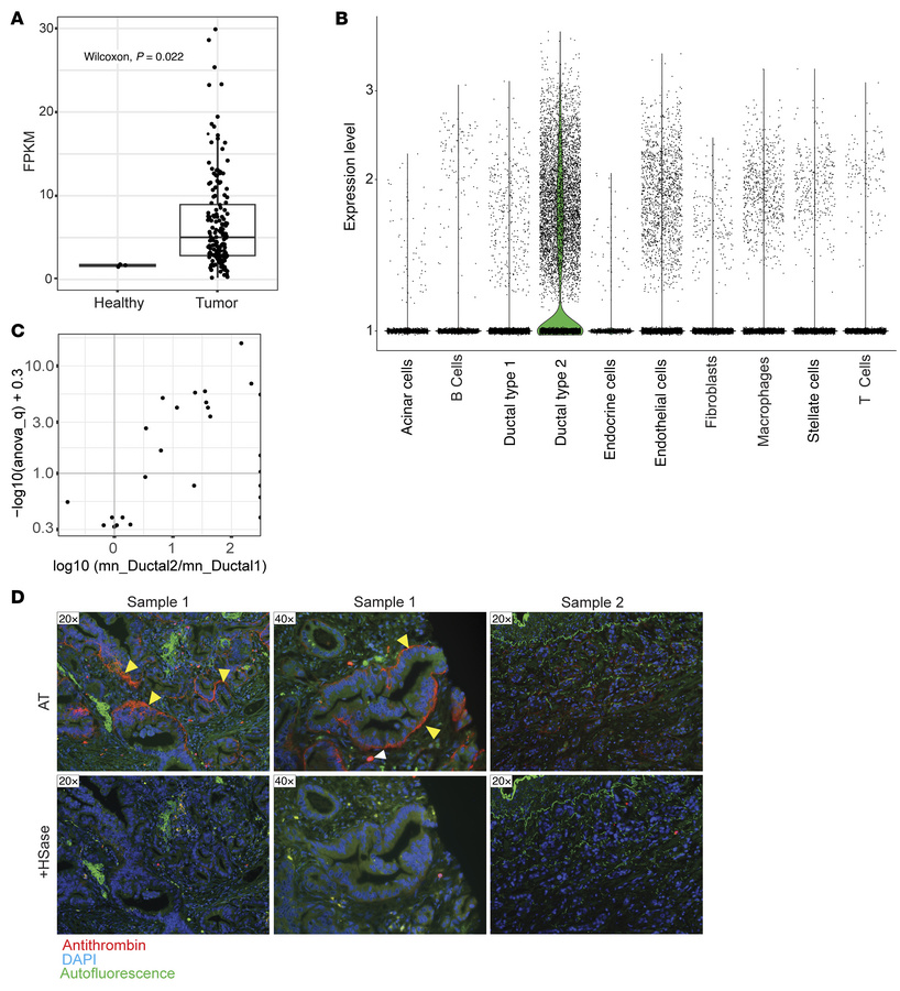 
HS3ST1 mRNA expression is upregulated in PDAC.
(A) HS3ST1 mRNA expressi...