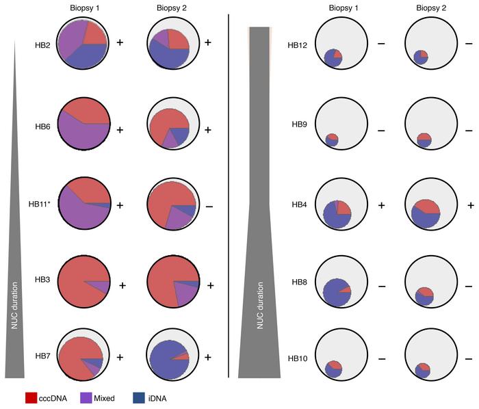 Changes in the cellular source of HBV transcription in paired biopsies d...