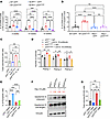 The NLRP1/IL-1β/GSDMD signaling axis is important for p53 mutant HSPC fitne