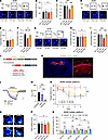 GluN2B suppression improves learning and memory impairment in PahEnu2 mice.