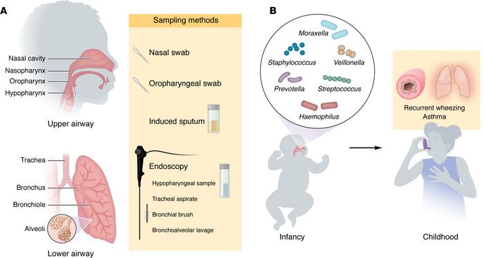 Airway sampling for microbiome studies and bacterial genera in the infan...