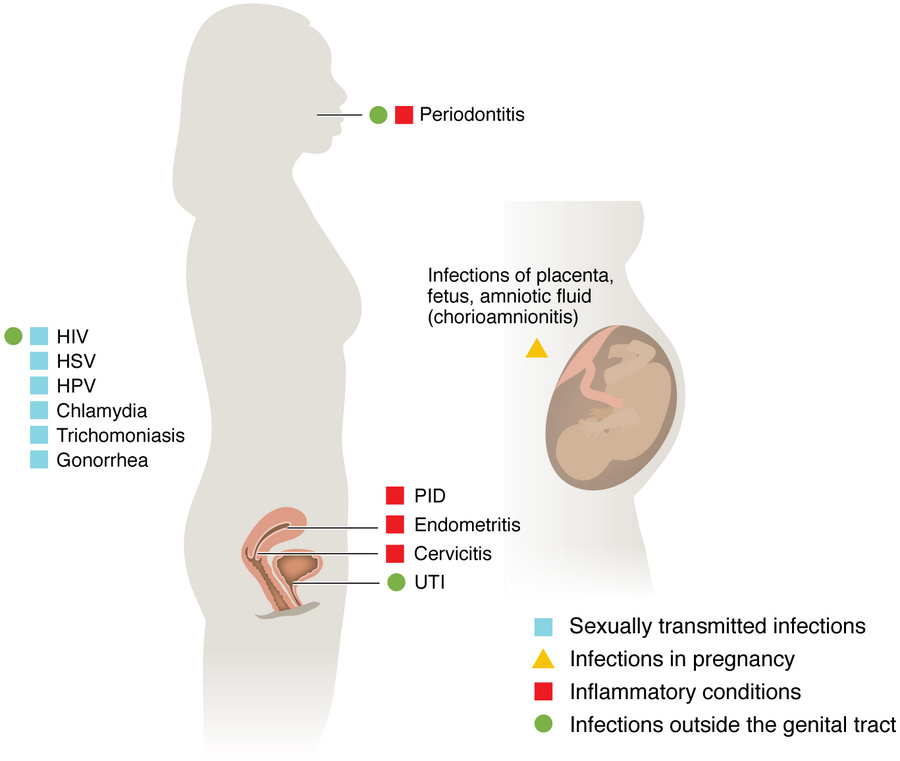 Infections associated with bacterial vaginosis fall into four main categ...