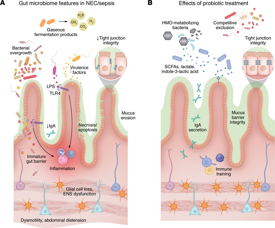 Pathophysiology of NEC and sepsis and potential probiotic effects.
(A) P...