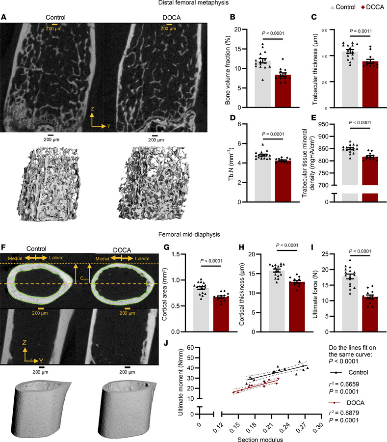 Trabecular architecture of the distal femoral metaphysis and cortical st...