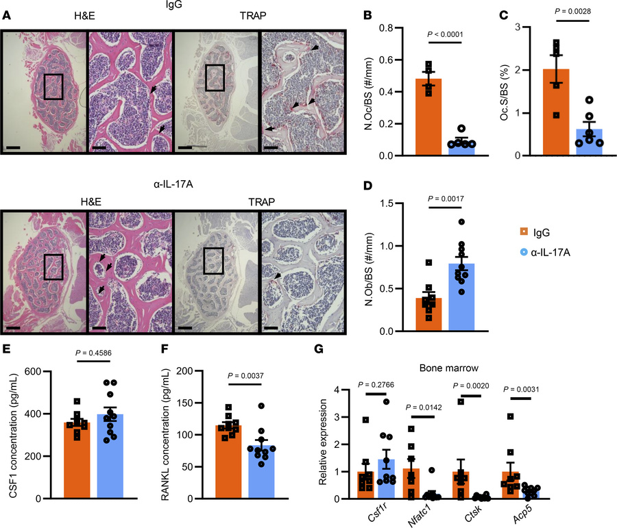 Analysis of osteoclasts in the bone and bone marrow from Ang II–infused ...