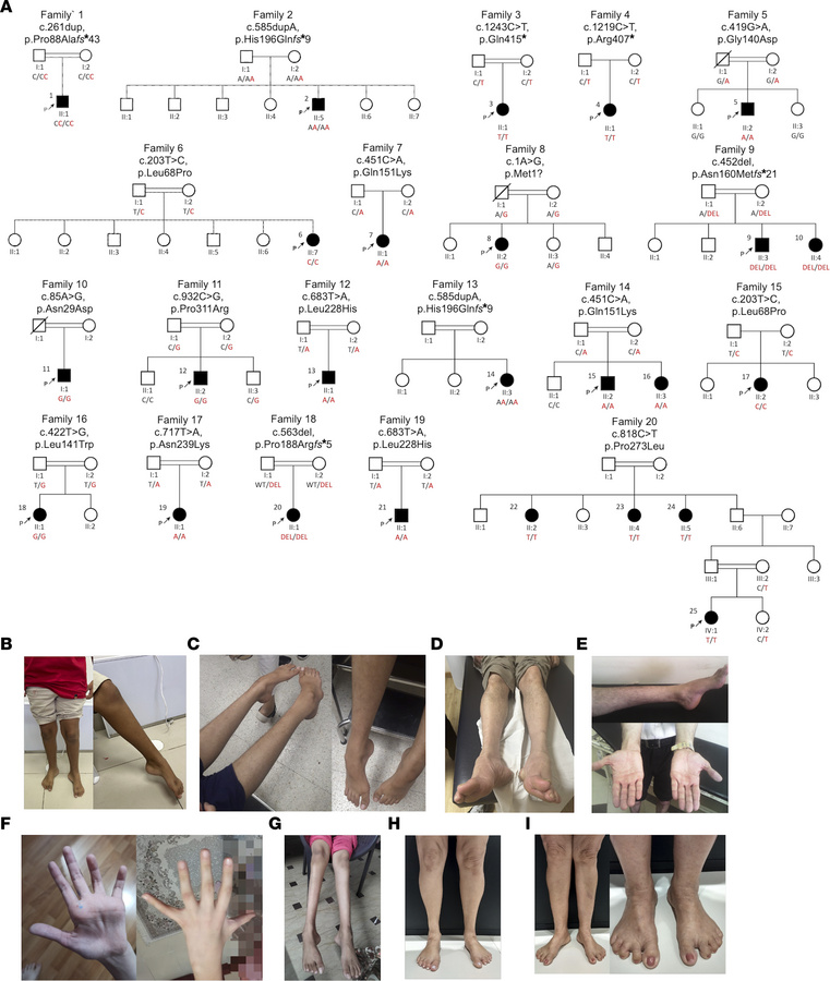 Genetic and clinical presentation of individuals harboring ARHGAP19 vari...