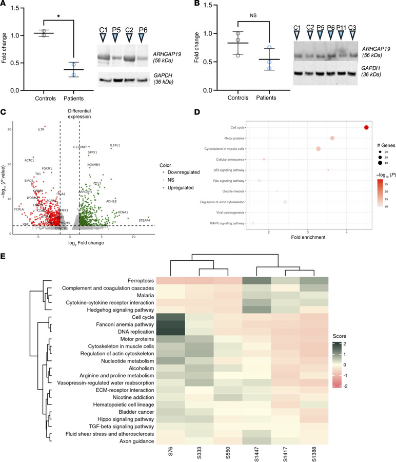 Western blot and RNA-seq analyses confirm downregulation of ARHGAP19 as ...